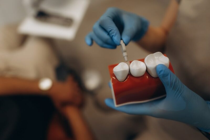 Hybridge Dental Implants Palmdale
