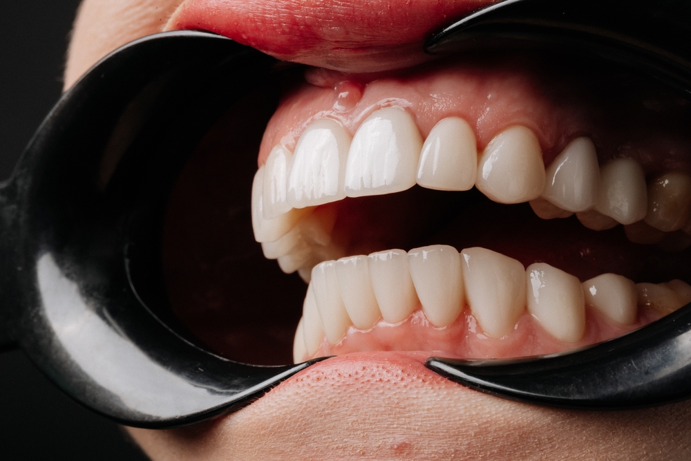 Orthodontics Palmdale