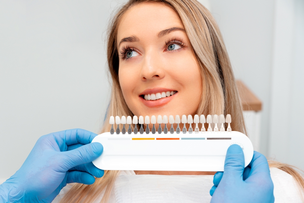 Veneers Palmdale